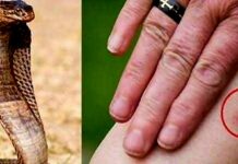 मध्यप्रदेश में सर्पदंश बनी आपदा